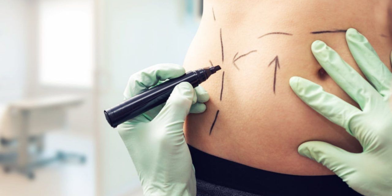 Recovery After Mommy Makeover Surgery: What to Expect and How to Heal Faster