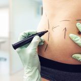 plastic surgery in cancun mexico