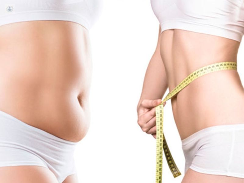 Body Contouring After Ozempic and Weight Loss in Cancun